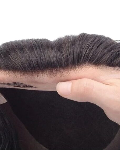 Thinning hair Solutions in Shelton CT